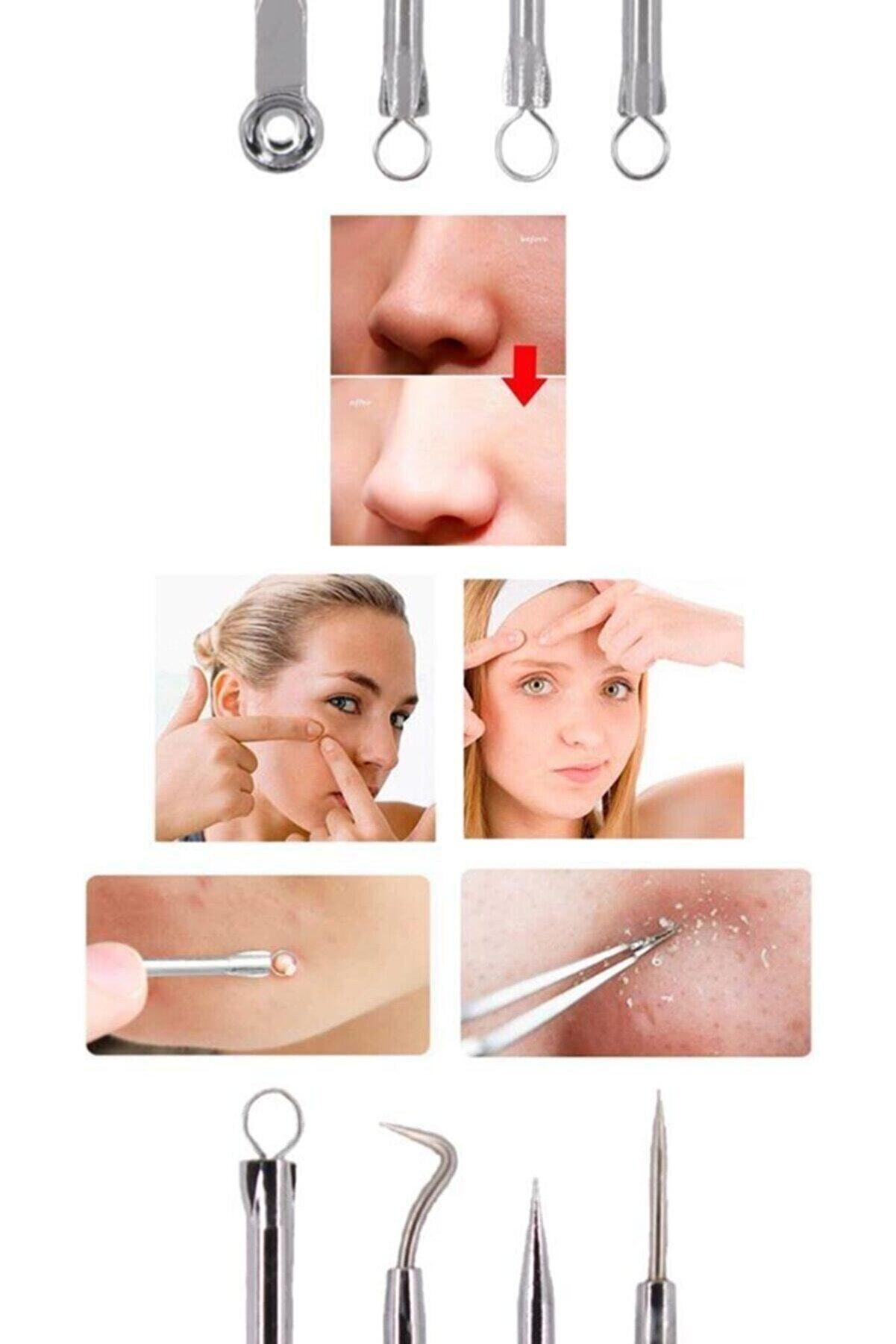 4 lü Kutulu Paslanmaz Komedon Akne - Siyah Nokta Temizleyici Set